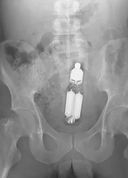 agfa drystar 14x17 dt2b / medical dry film agfa