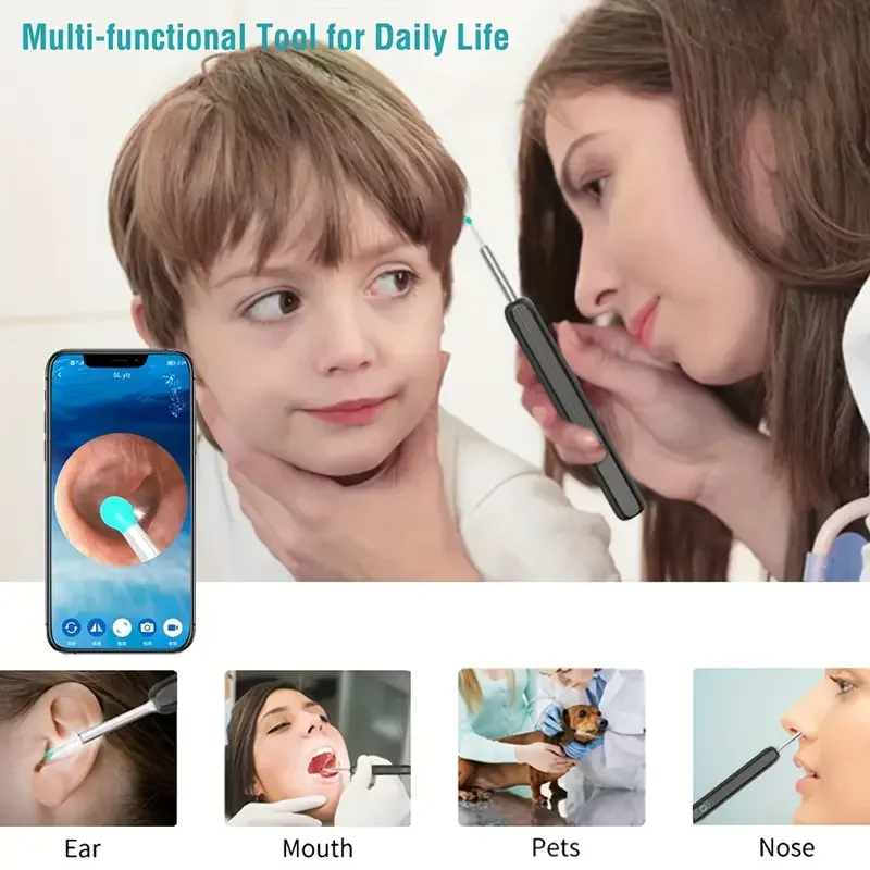 One-piece Wireless Visual Earpick- High Definition Earwax Remover with WIFI Function, Rechargeable Battery Visible Wax Pick