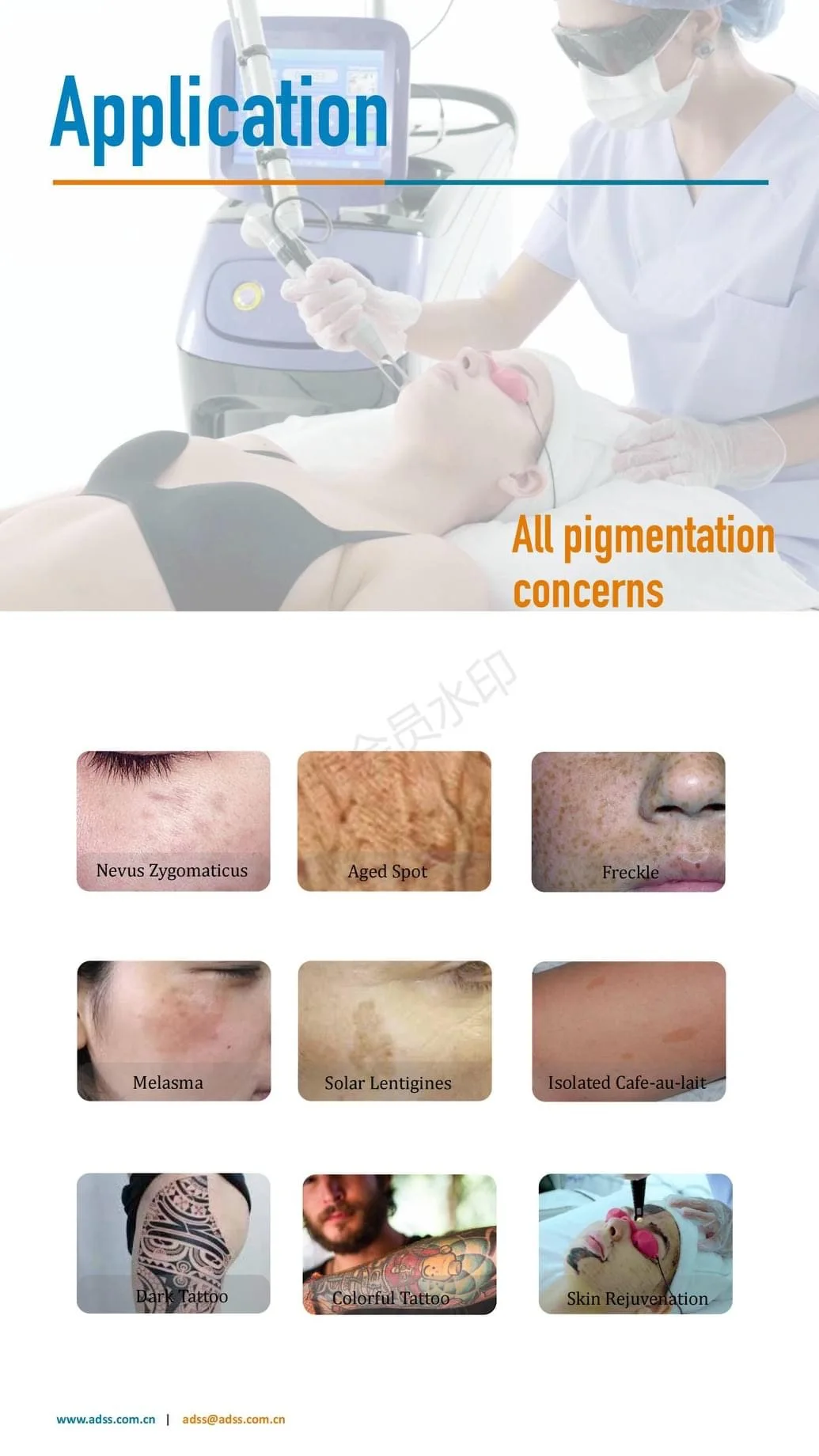 Picosecond Laser Pico Laser for Tattoo Removal and Skin Rejuvenation and Pigment Removal Pico