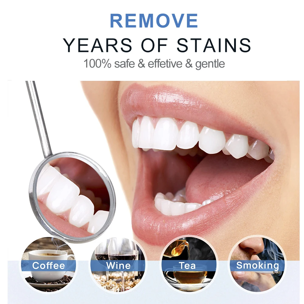 Hot selling Advanced bright white smiles teeth whitening led kit for home use