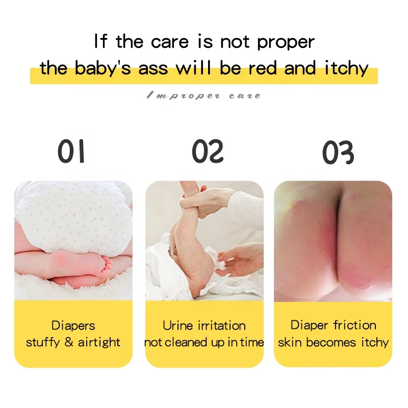 Healing Ointment Baby Sensitive Skin Care Wholesale Baby Diaper Rash Cream