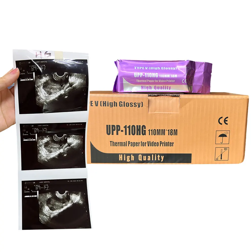 Medical 110mmx20m Accurate Sensor Mark Black White Printing Compatible Media Image Film Ultrasound Thermal Paper Roll