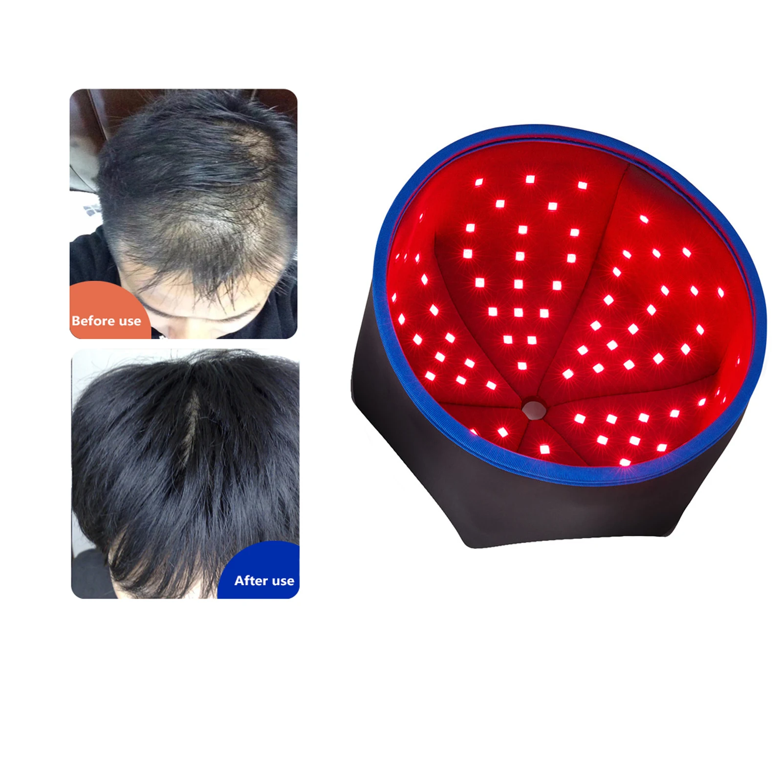 Infrared Device Treatment Machine Laser Led Regrowth Hair Growth Hat Red Light Therapy Cap Helmet For Hair Loss