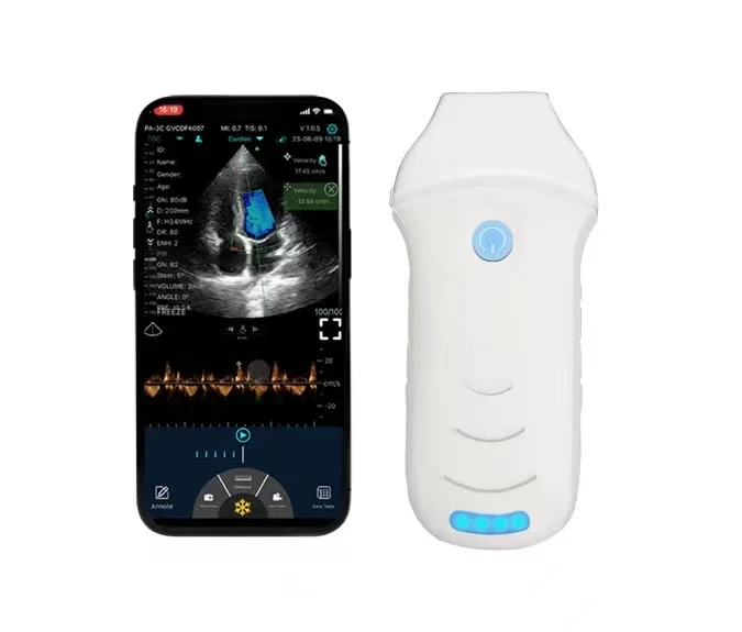 MC29 Very expert 2.2&3.6Mhz wireless phased array cardiac ultrasound probe USG with CW function on big sale