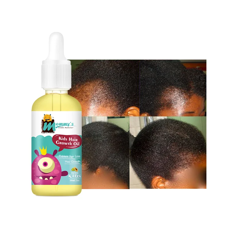 Mommy'S Little Monster Sultfate Free Cruetly Free Kids Baby Hair Growth Oil For Moisture And Nourish Scalp