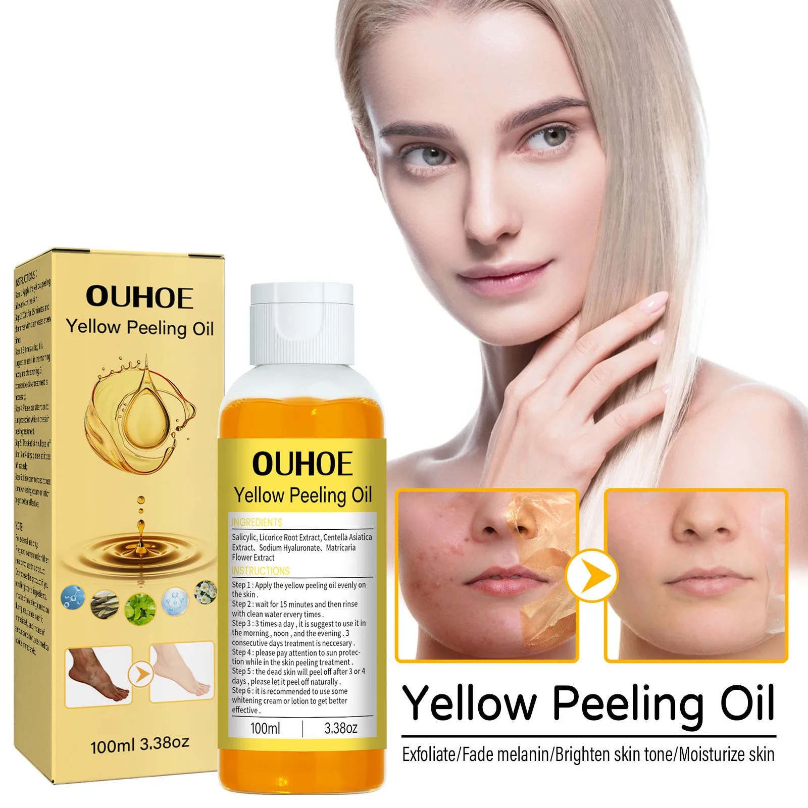 OUHOE Yellow Peeling Oil Supplier Nourishing Whitening Organic Lightening