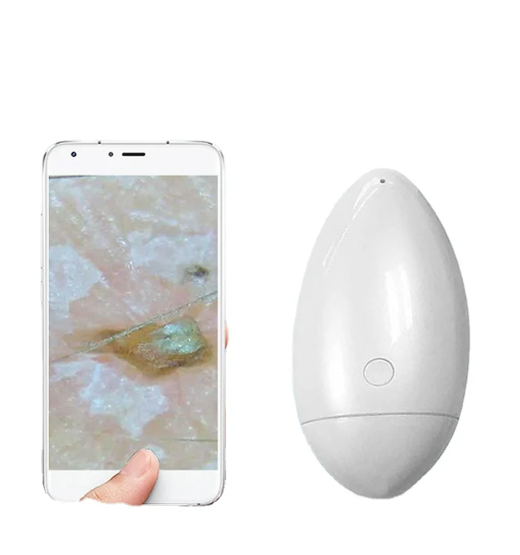 Portable wifi skin scanner can detect skin moisture pigment oil wifi scalp camera hair analyzer HD skin camera