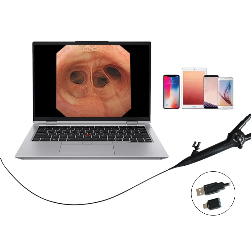 Портативная система эндоскопа USB/Tap C Электрическое Медицинское Оборудование видео уретероскоп для хирургических инструментов