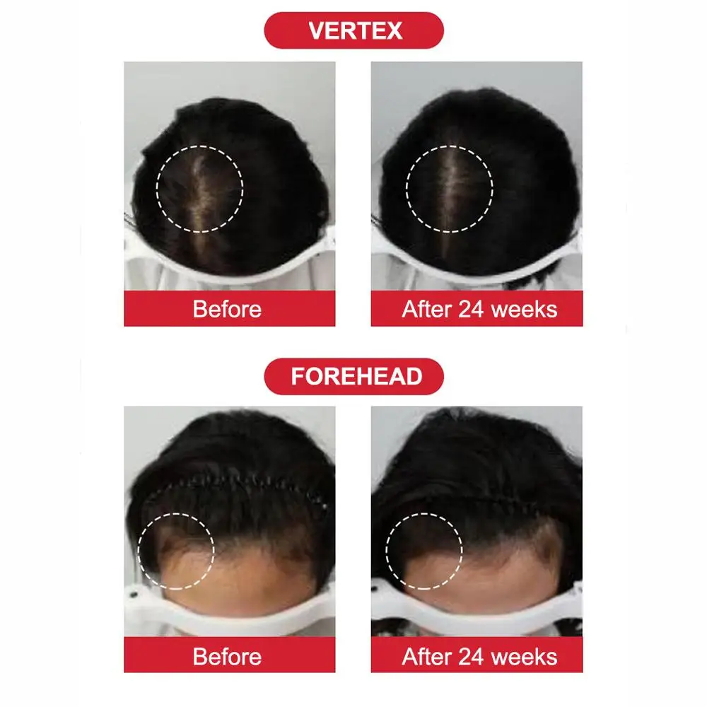 [Terapic] Terapic Premium Total Hair Tonic anti Hair Loss Care 150ml