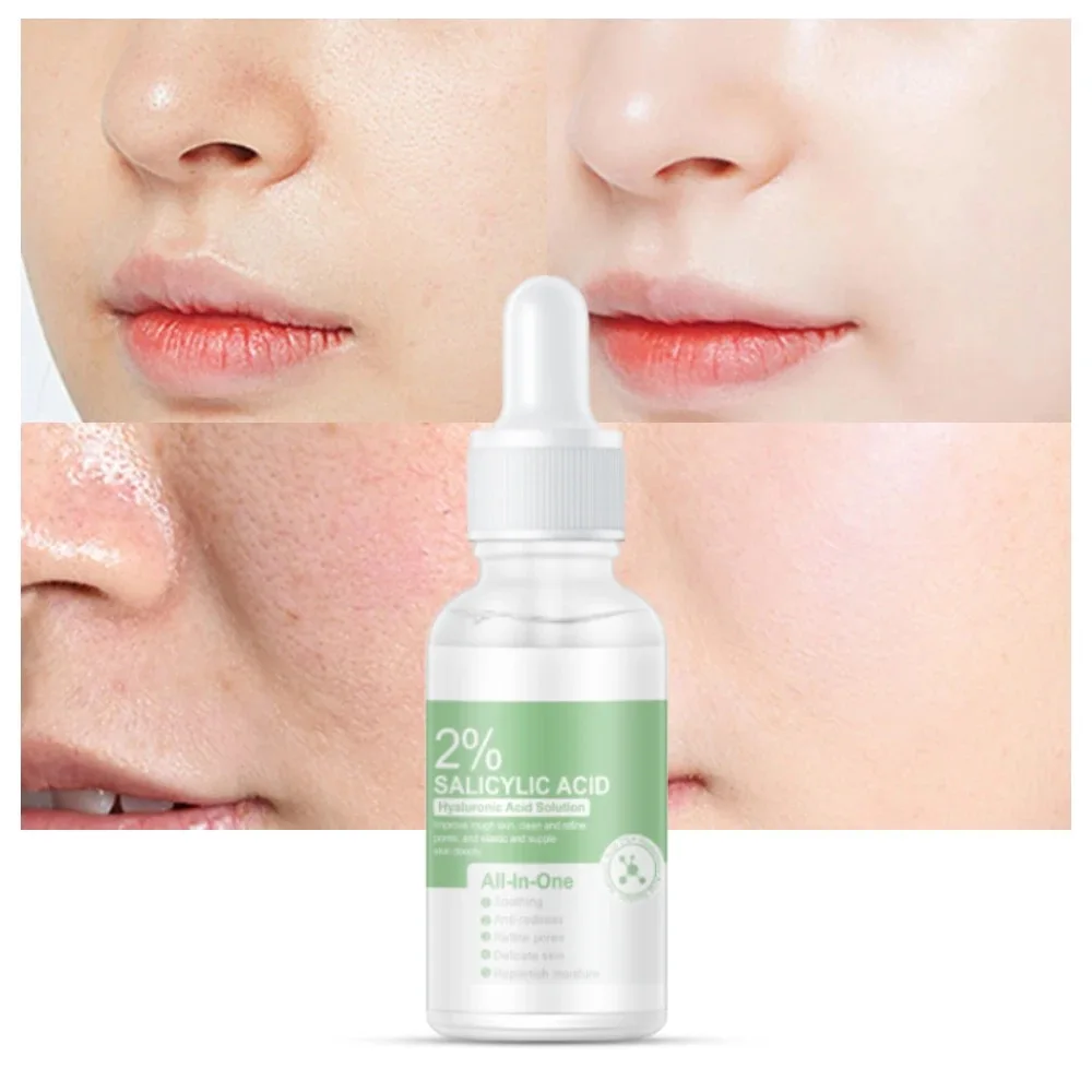 2% Salicylic Acid To Lighten Pores Hydrating Repair Acne Mark And Improve Skin  serum