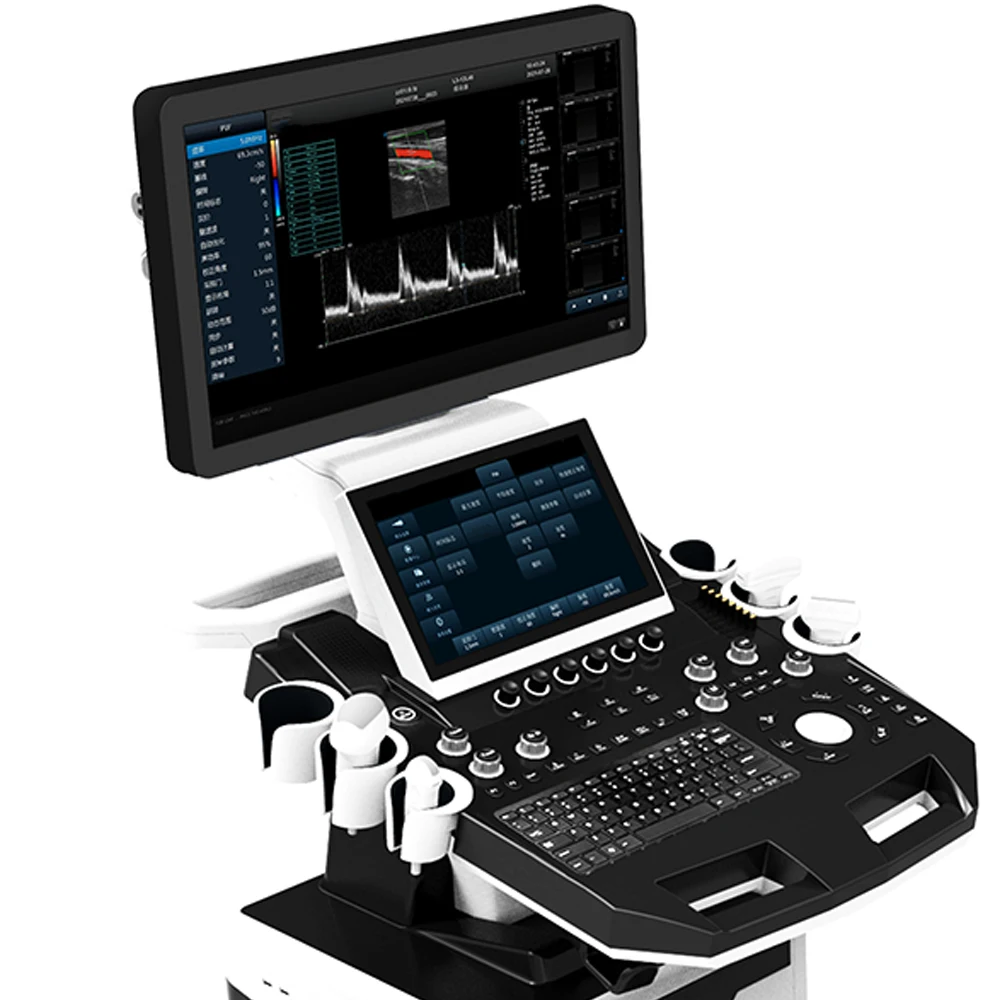 MY-A034D-N1 Dual screen cart type trolley Medical 3D 4D color Doppler 5D ultrasound machine price