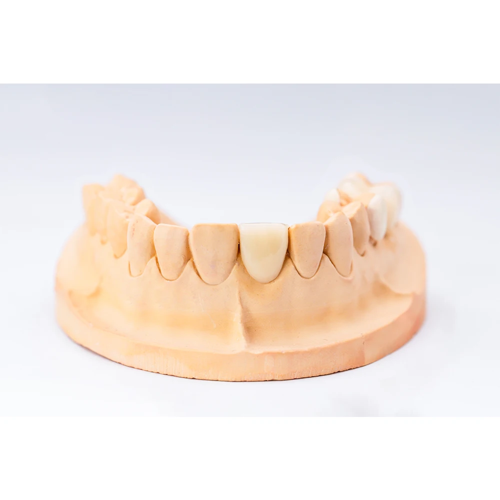 dental laboratory denture teeth fixed crown artificial tooth PEEK Composite Crown for dental clinic