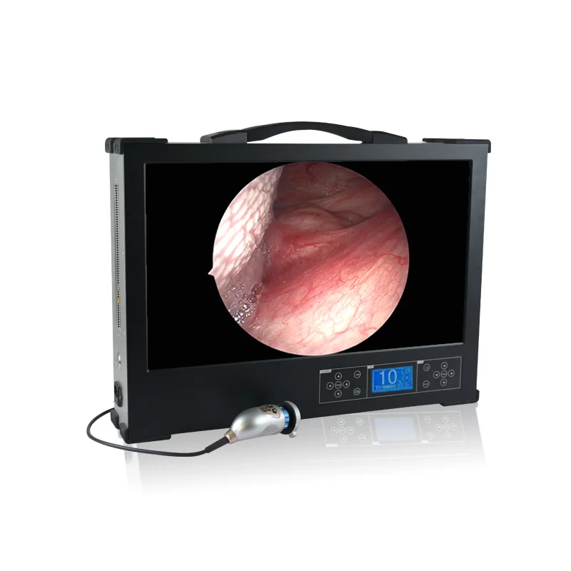 24-inch medical portable endoscopy machine for ENT/Laparoscopy/Hysteroscopy/Arthroscopy