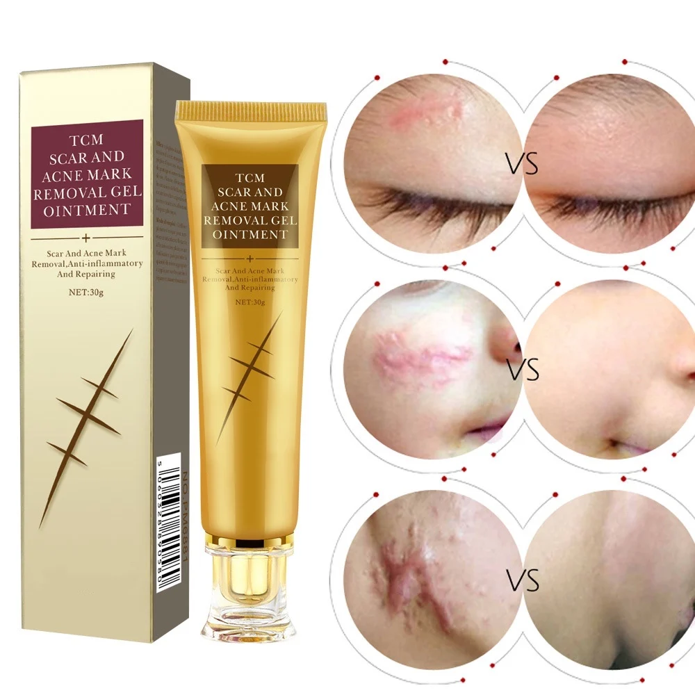 Skin Repair Face Black Dots Scar Removal Cream Facial Blackhead Scar repair Welcome to pick and buy.