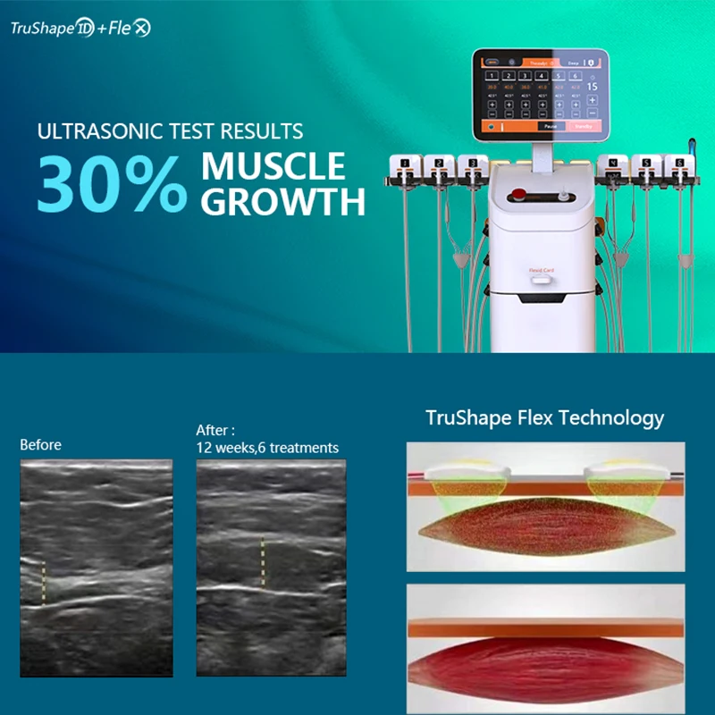 2023 новый дизайн аппарат для похудения Trusculpt ID Cutera Flex 2 в 1 коррекция фигуры салона