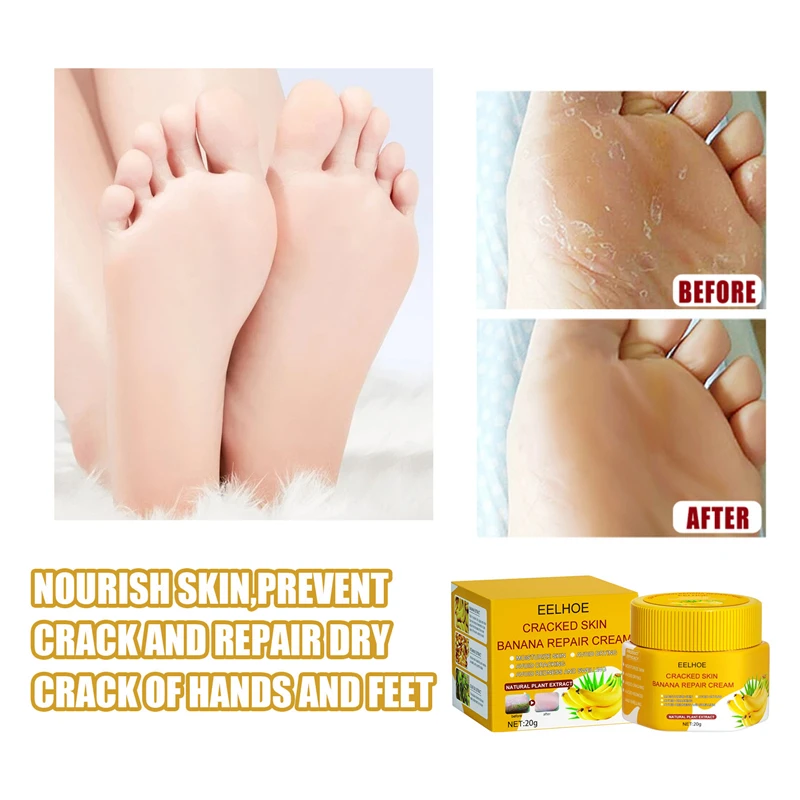 EELHOE cracked skin banana repair cream hand feet moisturizing heel cleft palate crack bleeding dry itches repairing cream