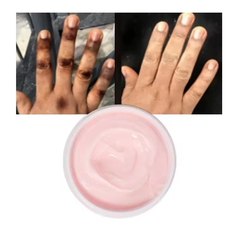 OEM Powerful Spot Removal Whitening Cream Repair Skin Dark Spot Correction Contains Arbutin Vitamin C Serum Natural Facial Care