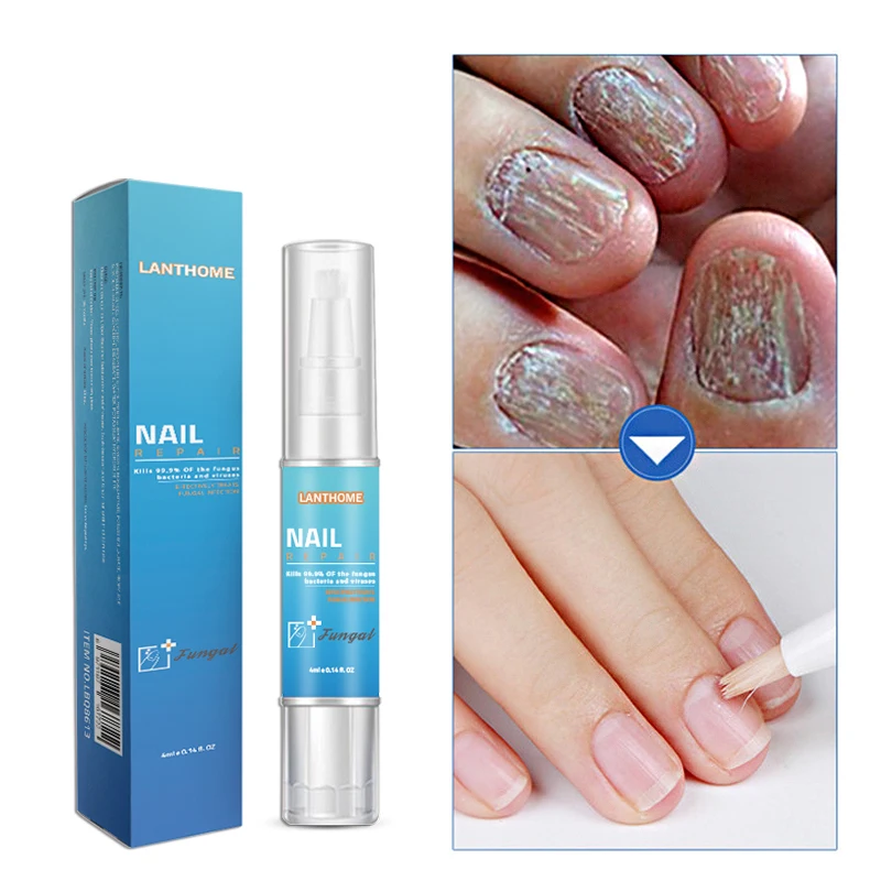 Private Label Antifungi Oil Fungal Infection Treatment Nail Repair