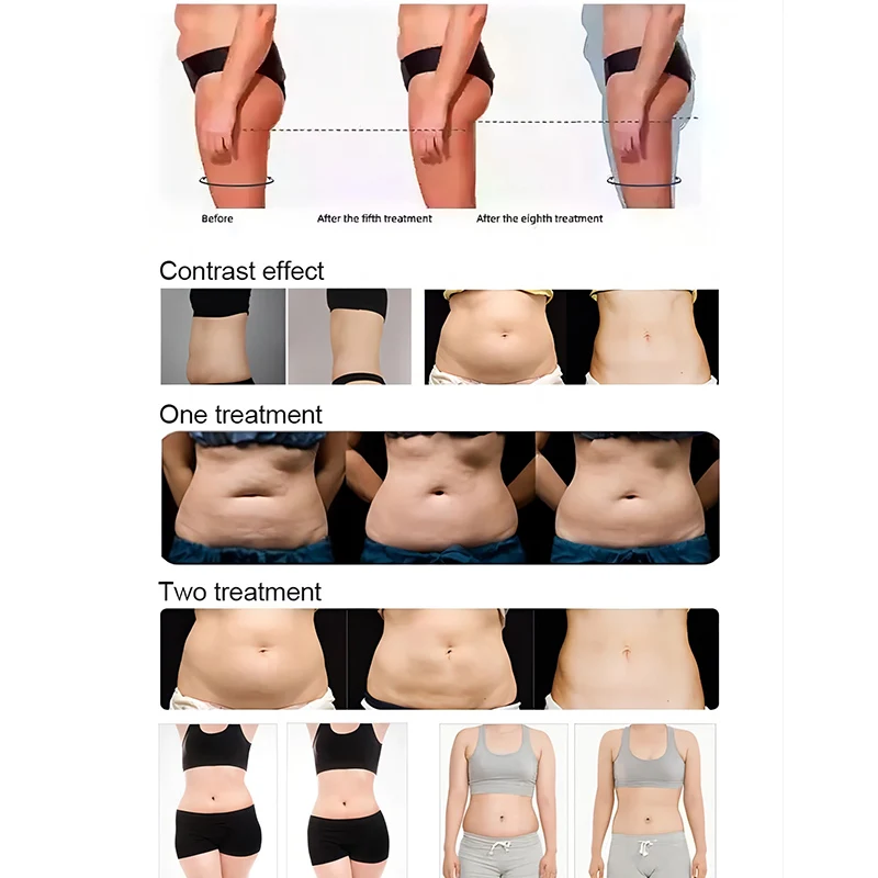 30 airbags pressotherapy lymphatic drainage machine body slimming pressotherapy device