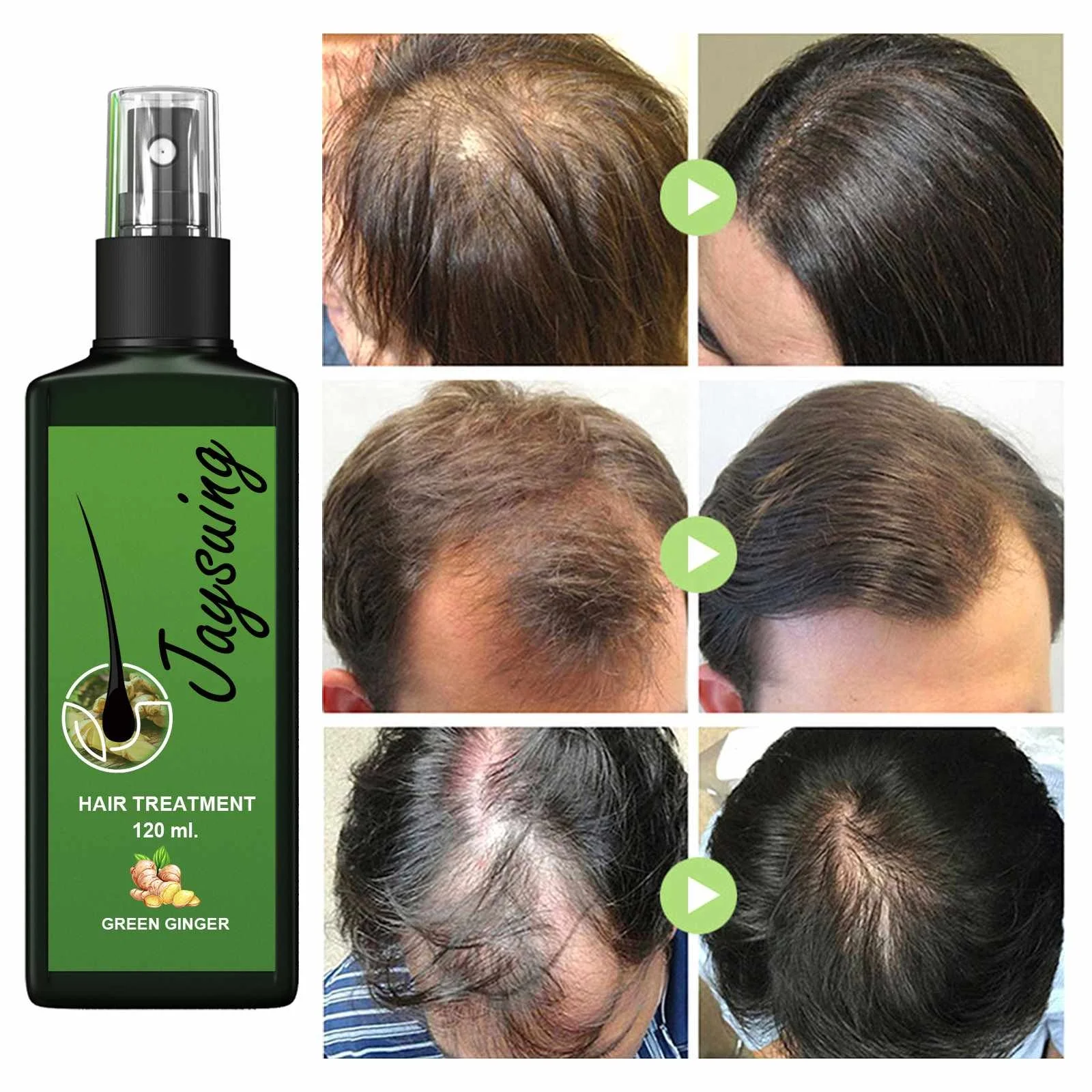 Hot Sale Natural Anti Hair Loss Hair Growth Scalp Care Treatment Ginger Germinal Serum Essence Oil