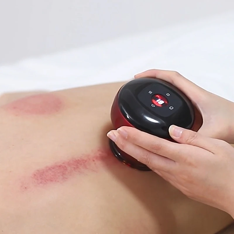 Hot Cupping Electric Vacuum Cupping Therapy Massager Guasha Hijama Cups Massage Tools