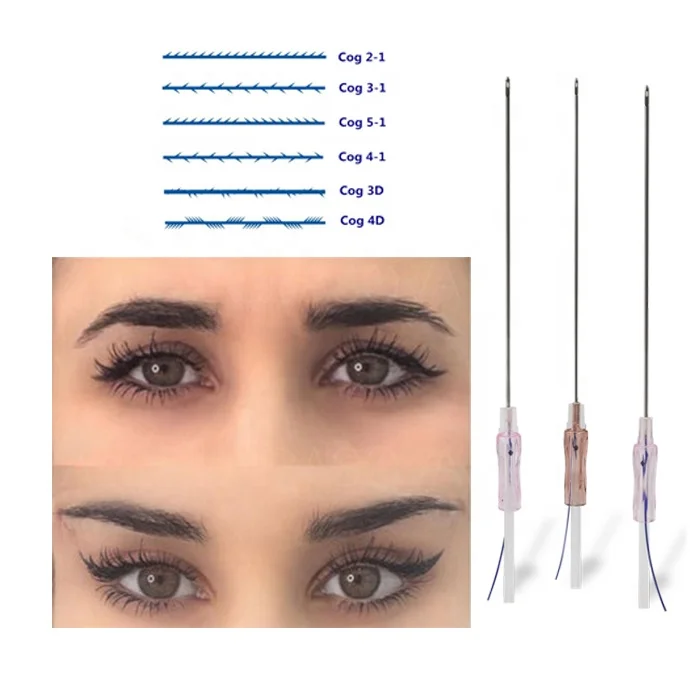 pdo cog 4d thread for lifting face and body pdo thread fox eye verified for sale 30g face thread pdo mono korea