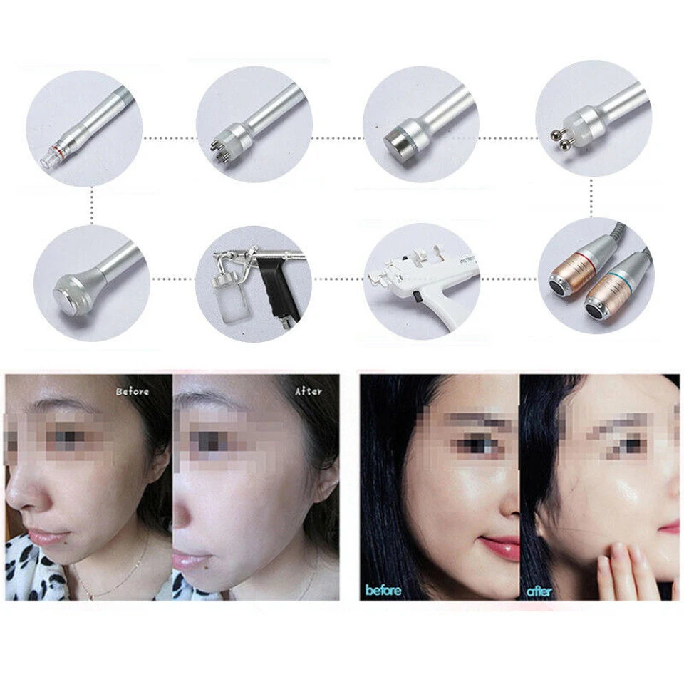 11 in 1 Hydra Dermabrasion RF Bio-lifting Spa Facial Machine Water Oxygen Jet Hydro Diamond Peeling Microdermabrasion
