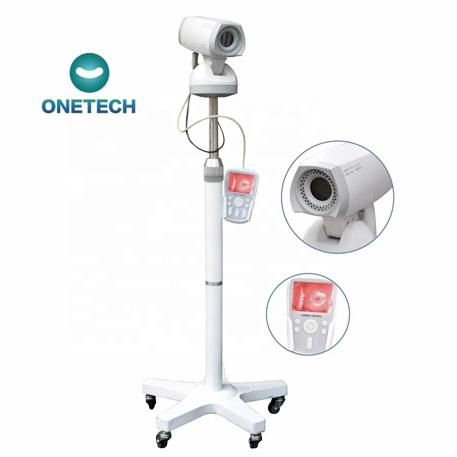 ONETECH B42A Hospital Video Colposcope Camera Gynaecology Video Optical Colposcope Electronic Colposcope