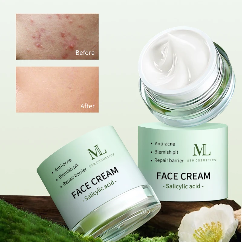 Private Label Beauty Skin Care 30ml 50ml Whitening Salicylic Acid Acne Treatment Face Cream