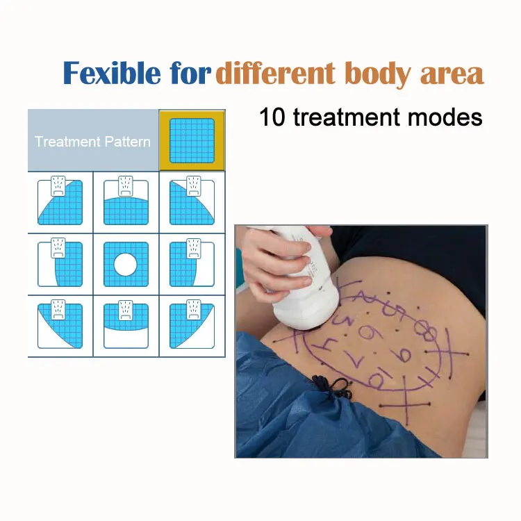 Top Hifu Lipo Machine Software Single Hand Best Cellulite 8mm y 13mm Hifu Transductores Training Lipo Hifu Body Slimming Machine