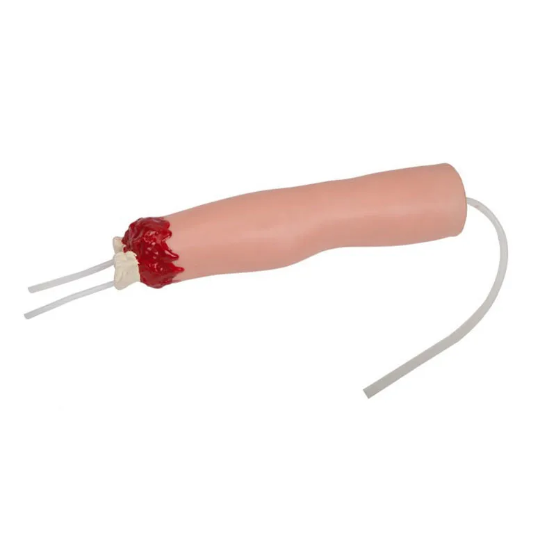 Medical Science Teahing Upper Limb Trauma Amputation and Hemostasis Nursing Training Model