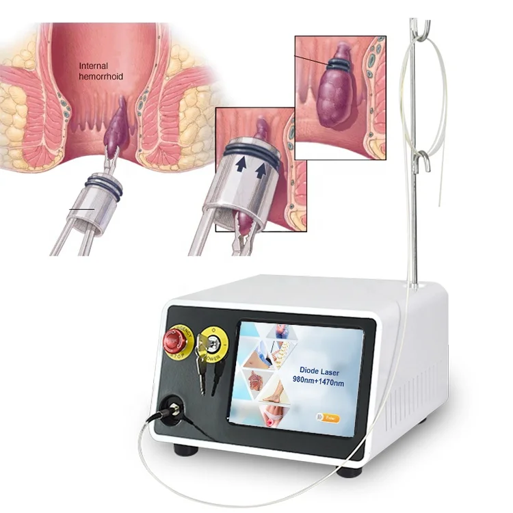 2023 Surgical device Anal Fistula and Hemorrhoids Diode Laser 1470nm 980nm Hemorrhoids Treatment surgery hemorrhoidectomy device