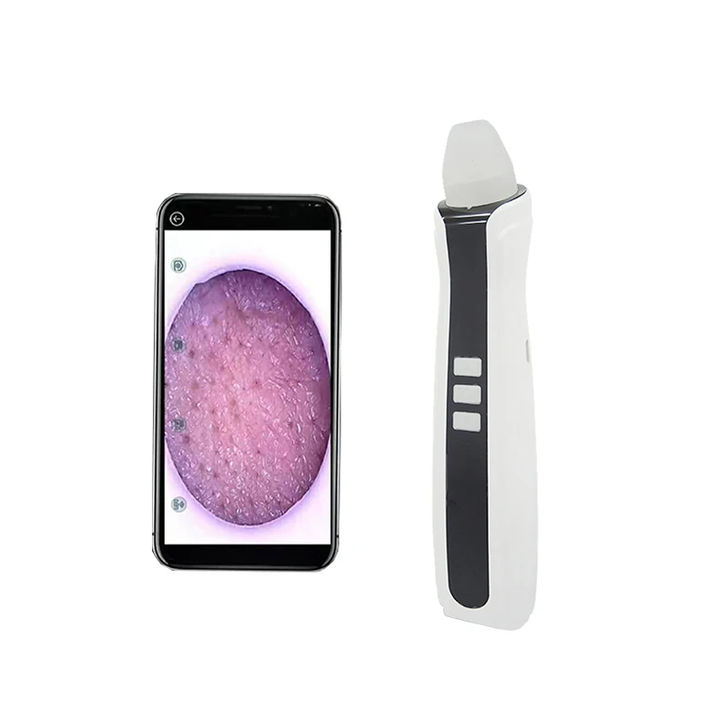 
Truelybeauty Visual HD Vacuum Blackhead Removal Suction Visual Blackhead Vacuum Remover Cleaner 