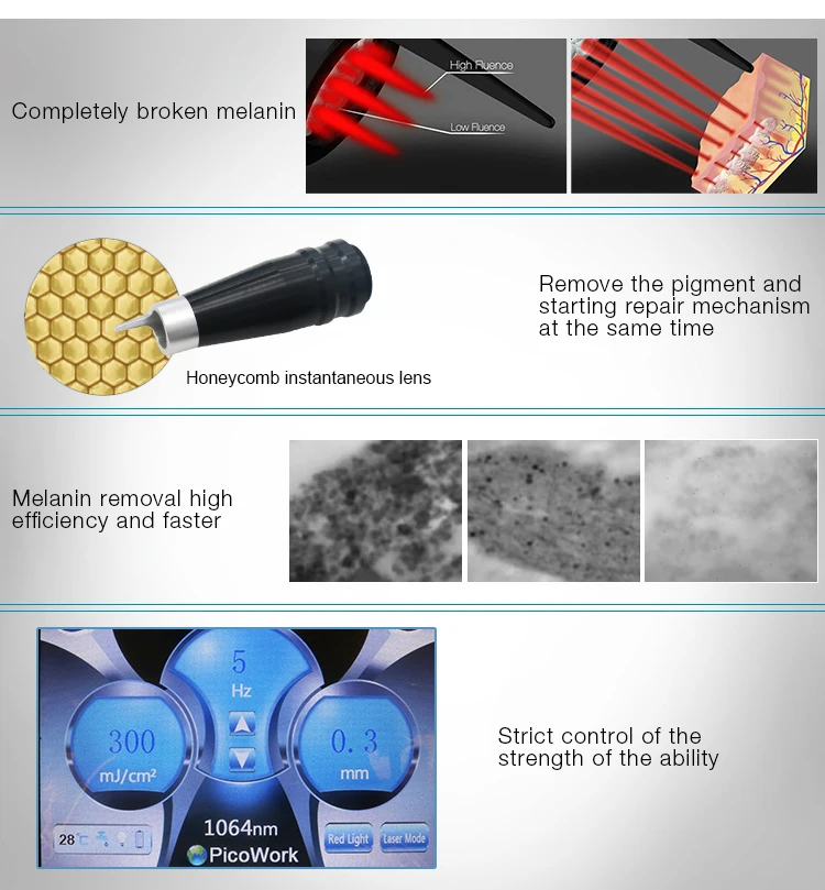Niansheng factory picosure picosecond q switched nd yag laser tattoo removal machine for carbon peeling freckle removal