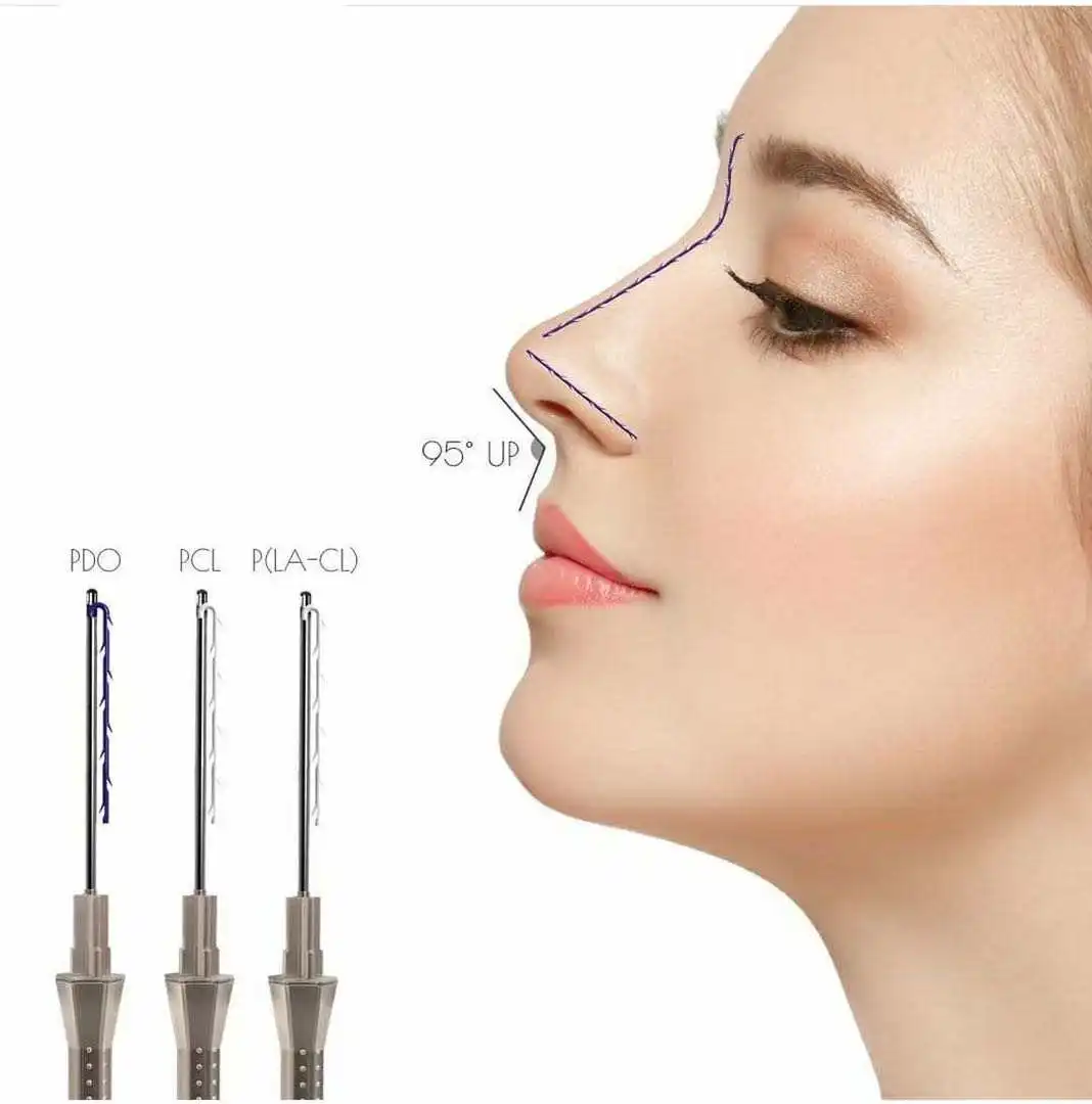 Cog thread pdo lift nose L Blunt 19G 38 мм для подтяжки носа