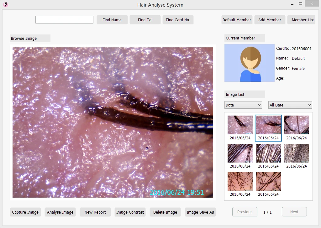 Face Problem Analysis Diagnose Skin Scanner 3D High Resolution UV Skin Detector Analysis Systems