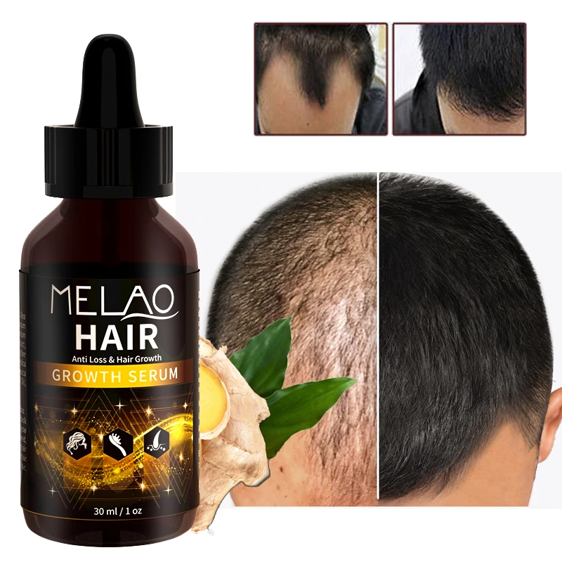 Natural Biotin Fast Grow Drops Anti Hair Loss Unisex Private Label Organic Argan Oil Strengthening Repair Hair Growth Oil Serum