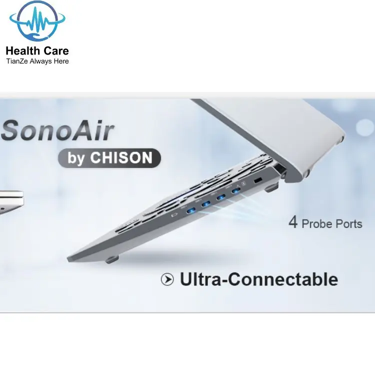 Chison SonoAir 70 Redefine the Future of Portable Ultrasound  perfect combination of powerful and good quality