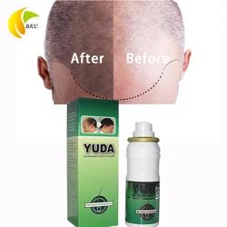 Hair Growth Products Yuda Fast Hair Regrowth Hair Loss Serum