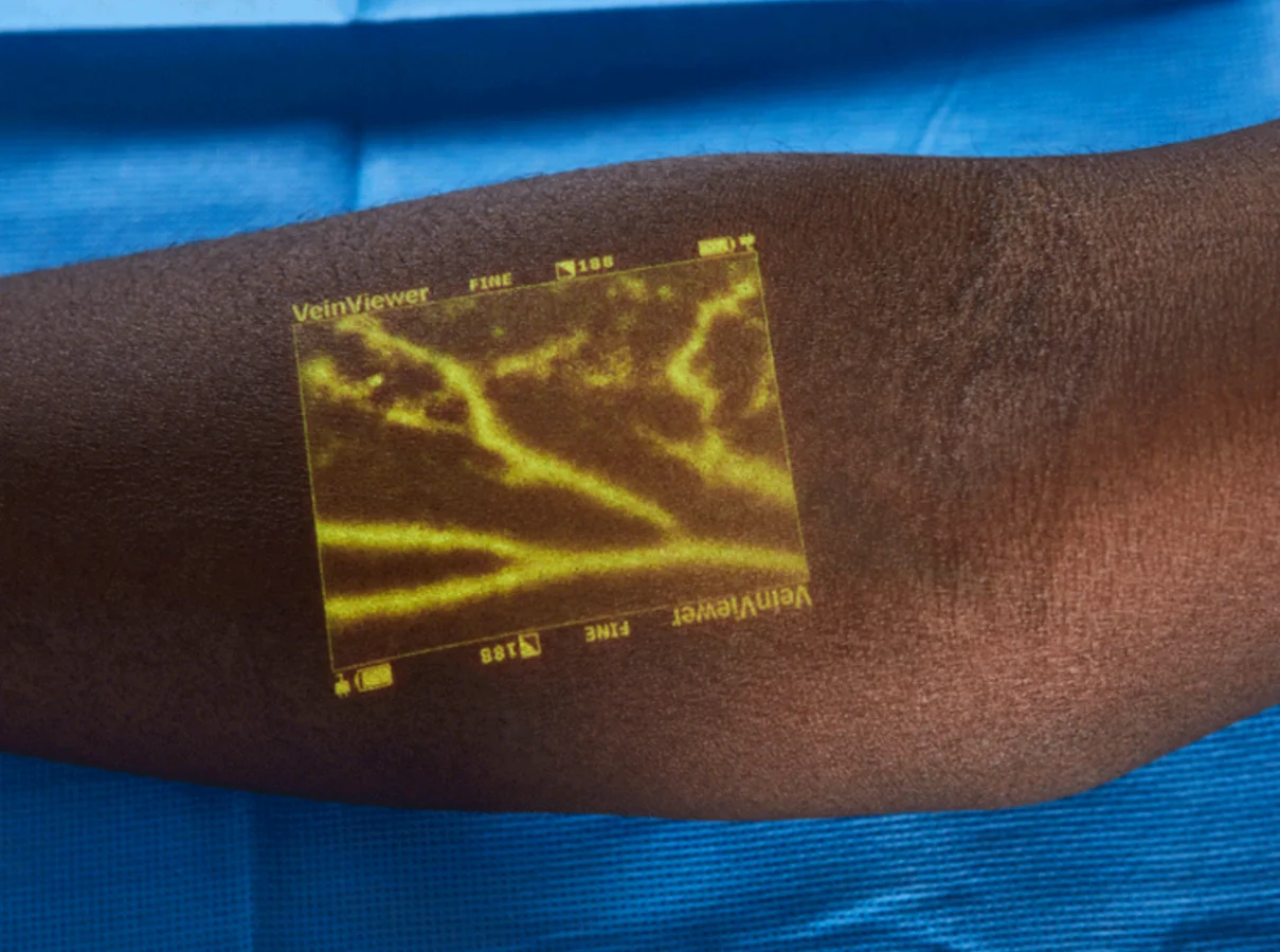 New Design Medical Infrared Illuminator Projection Vein Finder Vein Locator