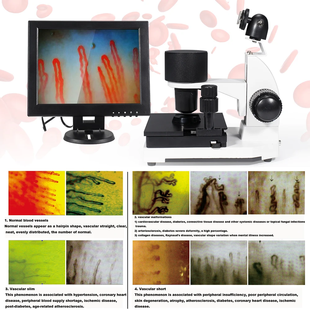 12 inch LCD blood circulation analysis clinical use analysis 680X Nailfold capillary microcirculation microscope