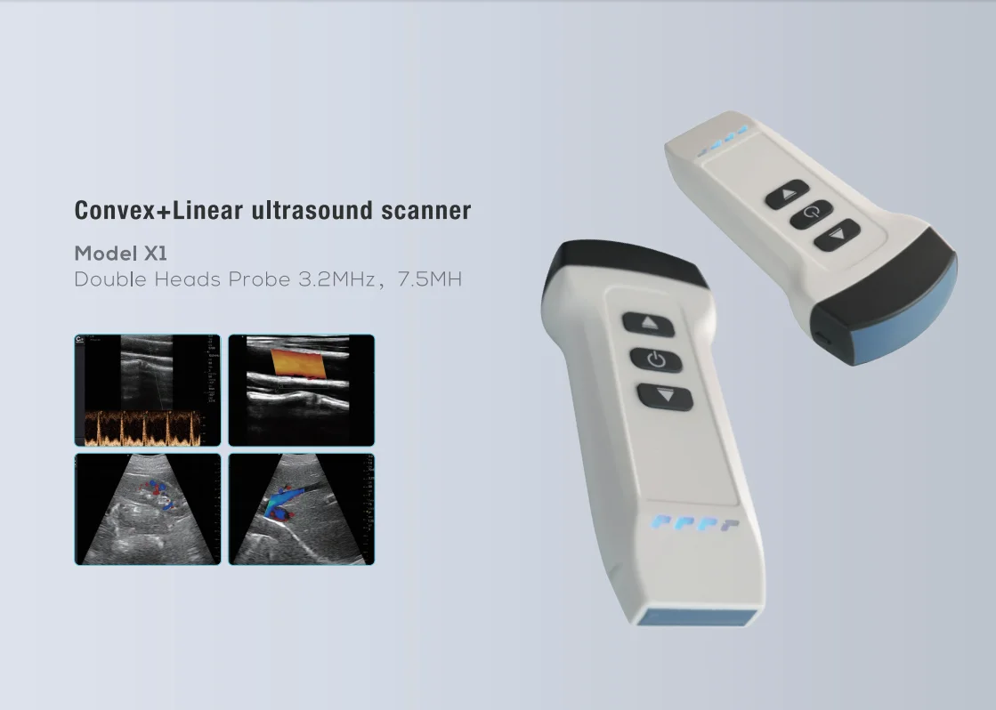 3.3MHz Wireless Convex WIFI Connected Handheld Ultrasound Machine Handheld Wireless Ultrasound Probe Portable Android IOS System