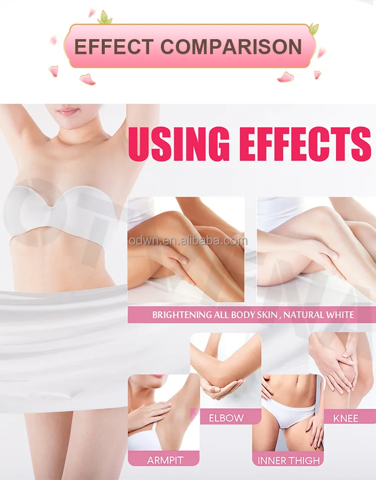 Oem Pimples Melasma blemish brighten dark spot corrector remover cream Strong bleaching whitening face freckle remove cream