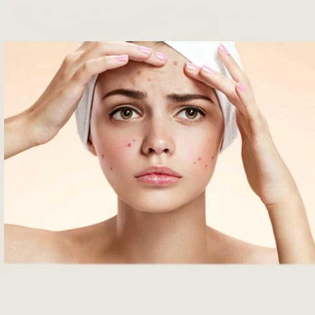 Herbal Effective Anti Acne Skin Whitening Honeysuckle Gluta thione Pills Capsules