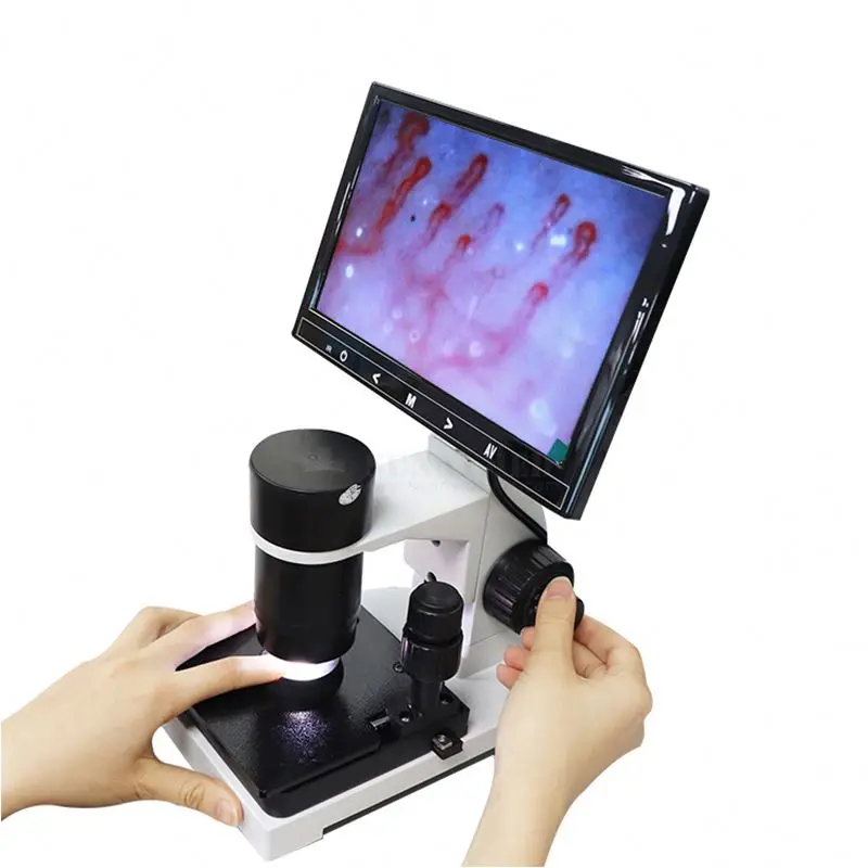 SY-B198 Blood Capillary Microscope Independent LCD Screen Finger Capillary Microscope