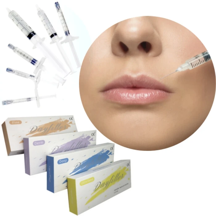 Korea Hyaluronic Acid Injection Dermal Fillers Lip Filler 1ml 2ml Sodium Hyaluronate Dermal Filler
