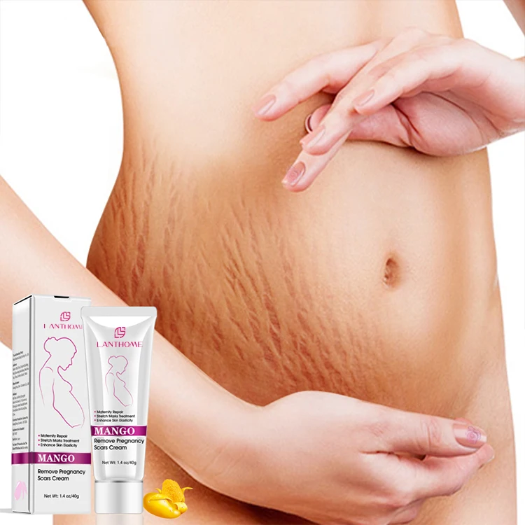 Make Your Own Body Skin Care Skin Repair Remove Clear Pregnancy Scar Removal Stretch Mark Cream