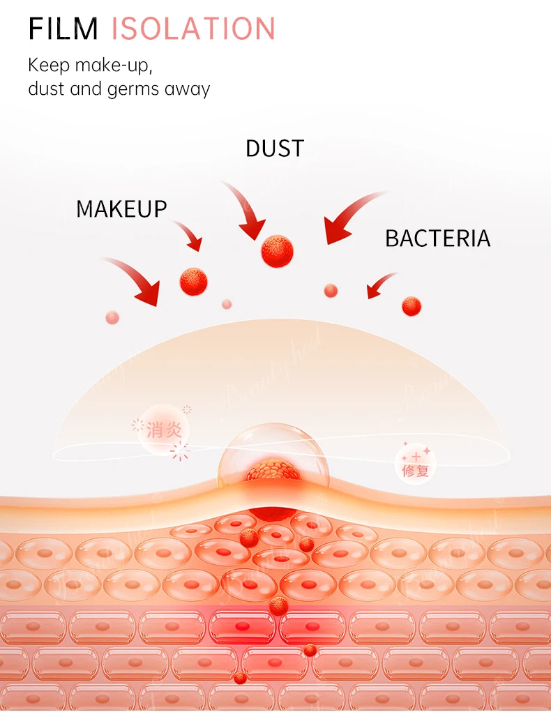 Acne Solution Face Cream Pure Repairing Soothing Acne Scar Removal No Side Effect Moisturizer Glowing Pimple Dark Spot Treatment