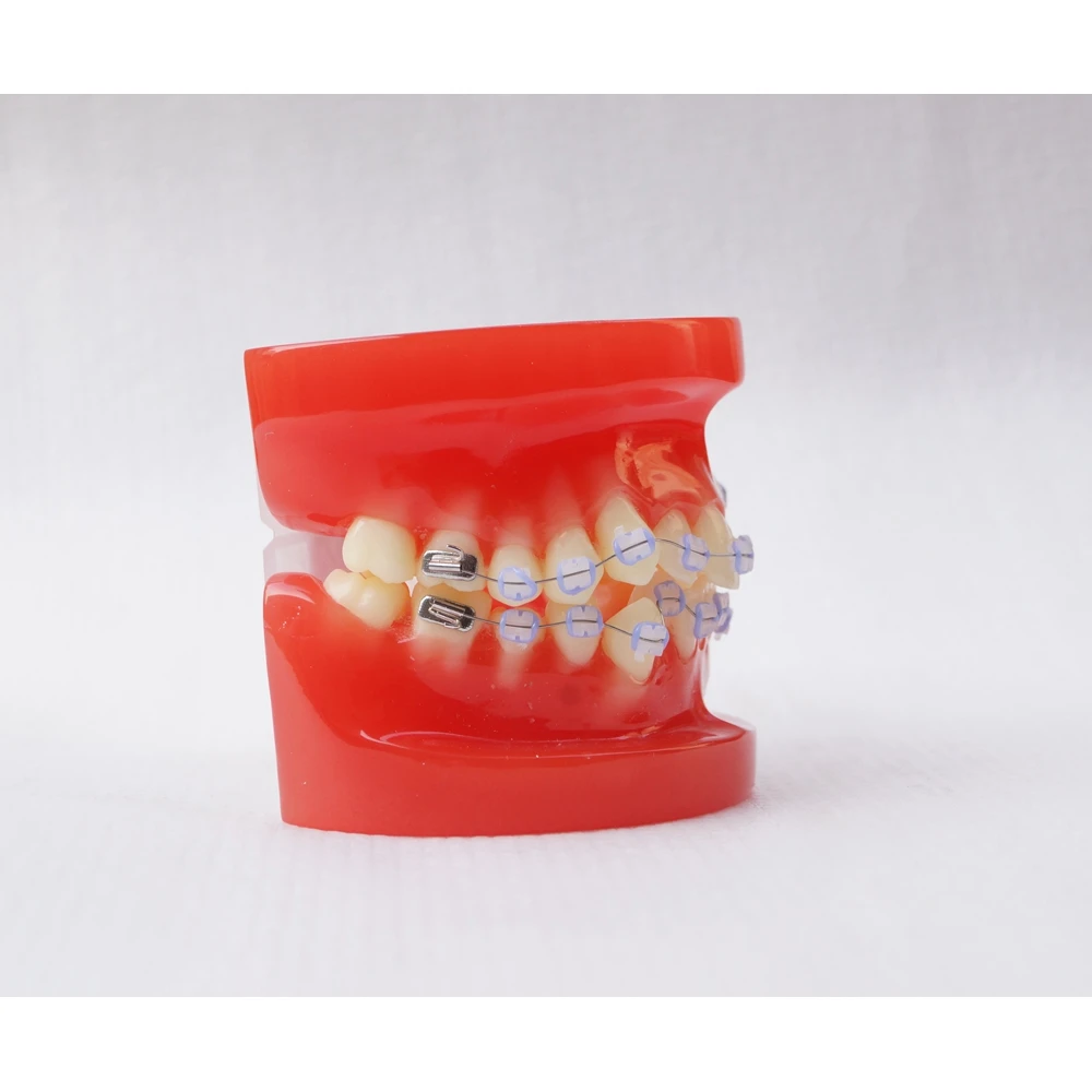 Dental Typodont Model Study Teeth Model With Ceramic Bracket