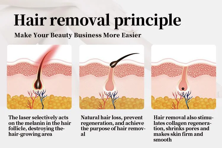 2022 Newest Professional Manufacture Soprano Titanium 808nm Diode Laser Hair Removal Device For Beauty Clinic